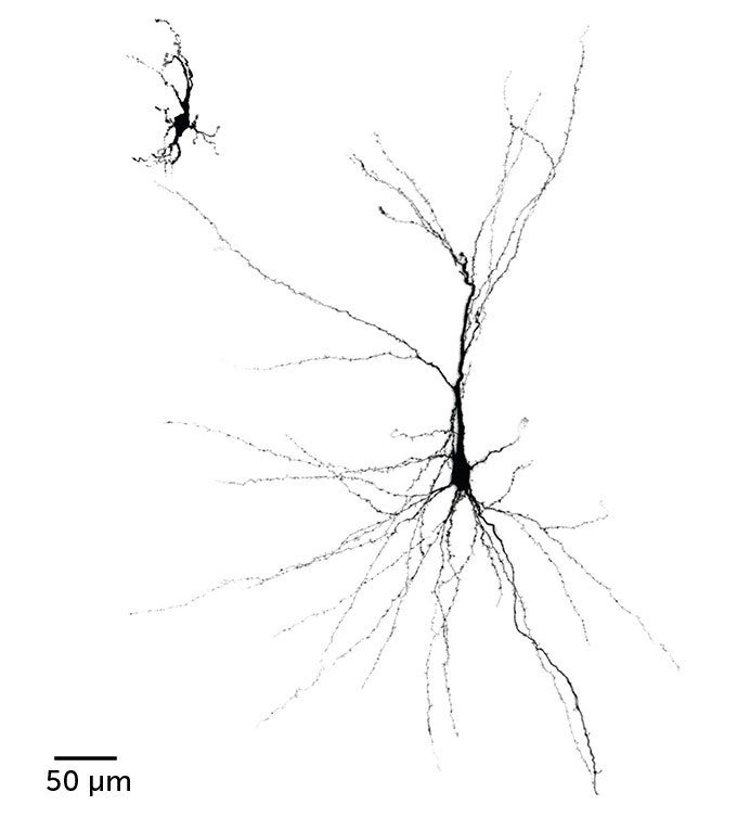 Top left: A human nerve cell grown from an organoid in a laboratory dish.  It is much smaller, with a much shorter 'pencil', than the nerve cell grown from the organoid in the brain of the rat, because the long spind 'pencil' covers most of the image.