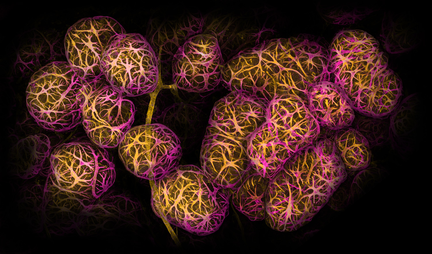a ball-like structure of magenta and yellow clustered around a blood vessel, colored yellow against a black background.