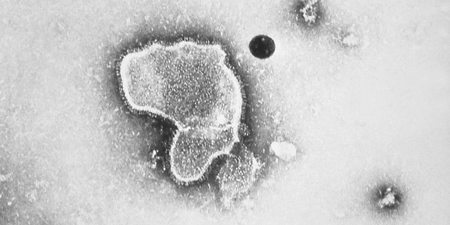 This transmission electron micrograph reveals the morphological traits of respiratory syncytial virus (RSV), 1981. 