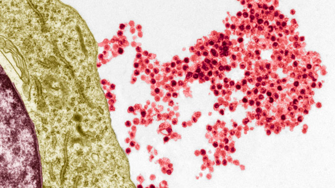 electron micrograph showing Epstein-Barr virus from the immune system B cell