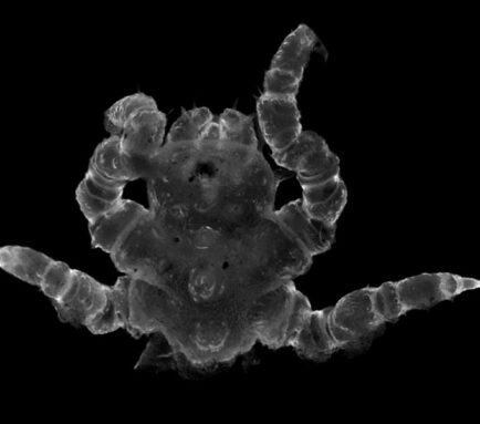 A microscope image of the same young sea spider without the three stubs.