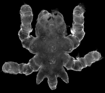A microscope image of a young sea spider with three small stubs at the bottom of its body.