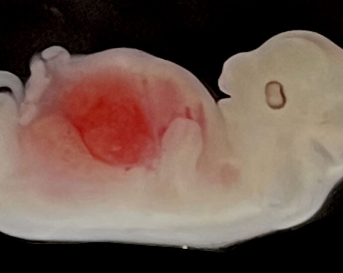 An image of a pig embryo seen from the side with a large patch of red visible in its stomach.